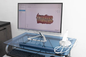 Цифровой интраоральный сканер сенсорный