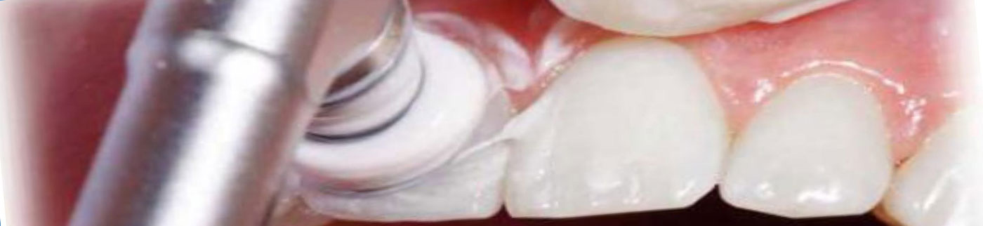 Профессиональная гигиена зубов в Люберцах