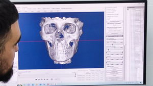 Обучение по новейшему цифровому Аксиографу SDIMatriX Обучение по новейшему цифровому Аксиографу SDIMatriX